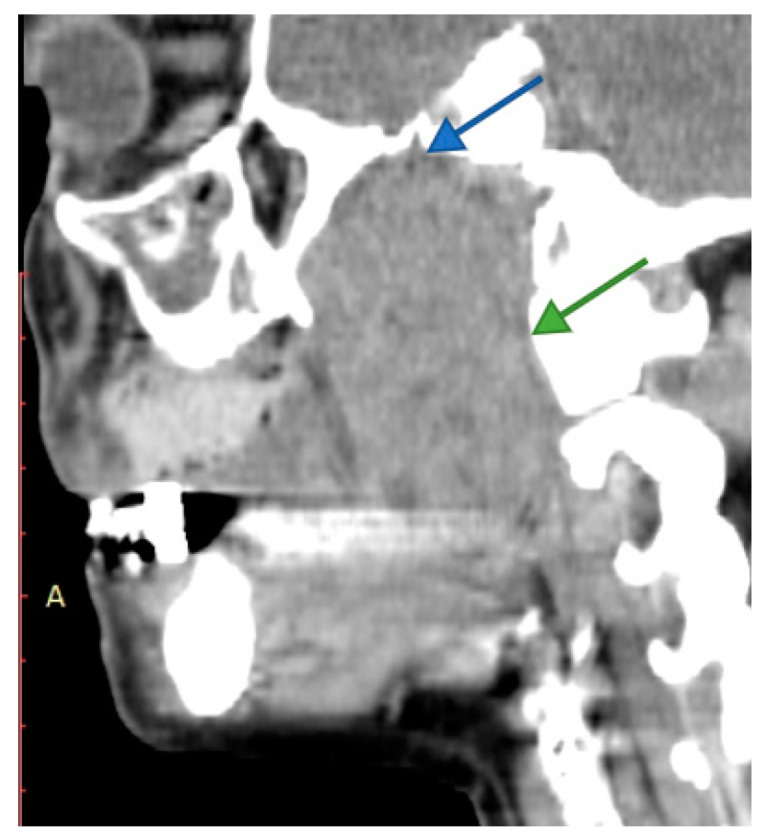 Figure 6