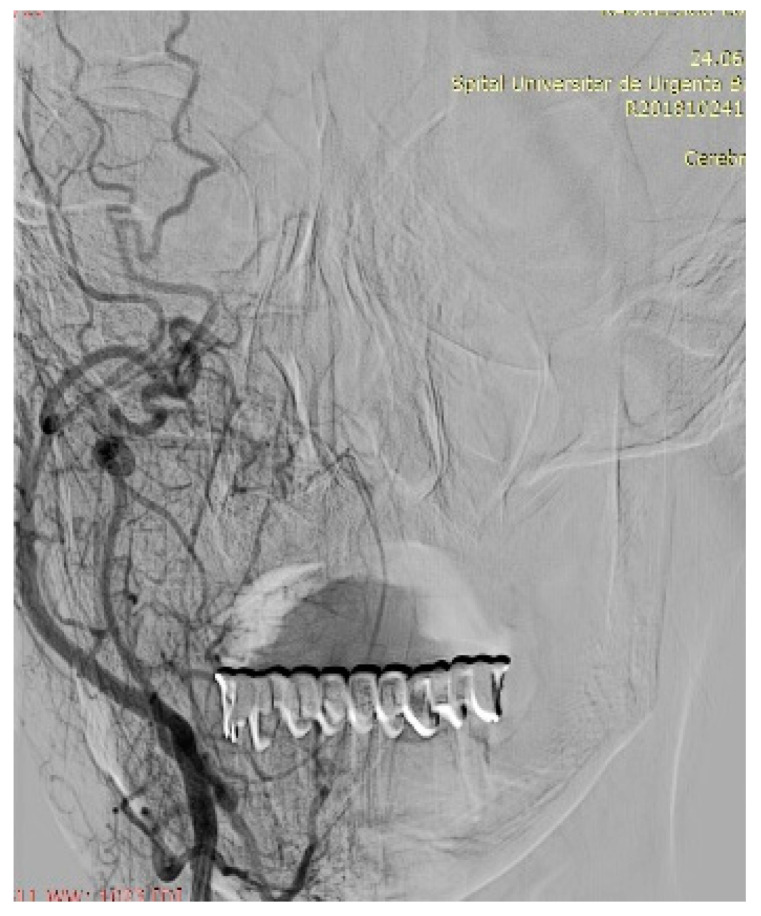 Figure 12