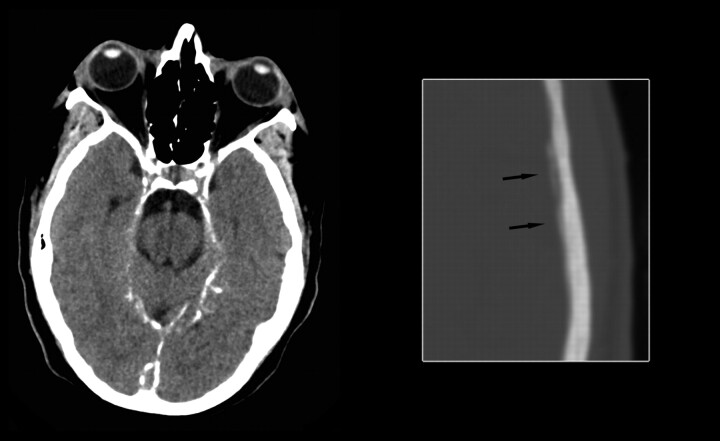 Fig 3.