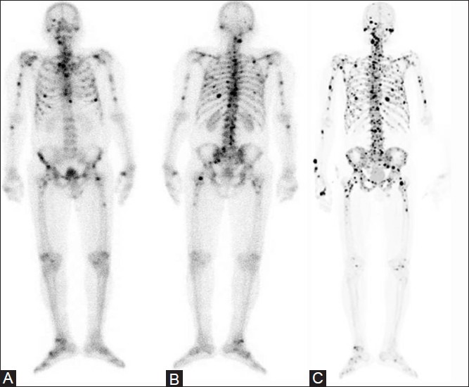 Figure 4(A-C)