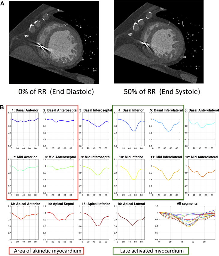 Figure 1