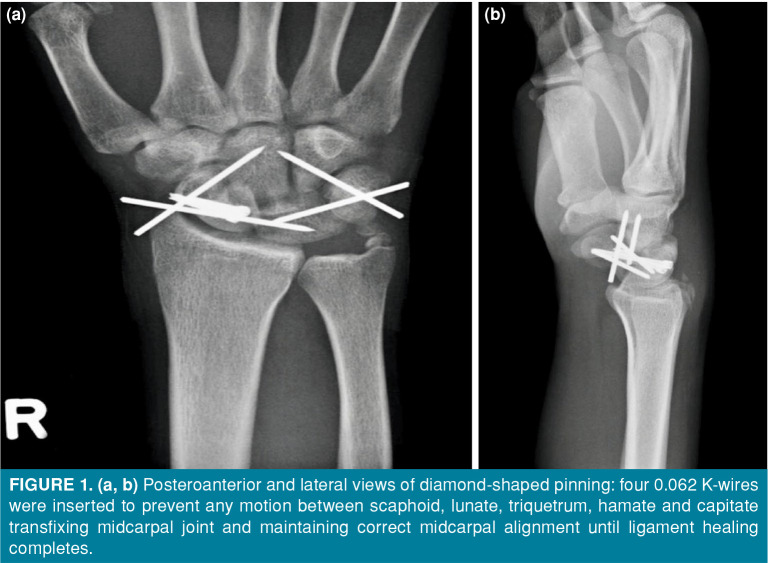 Figure 1