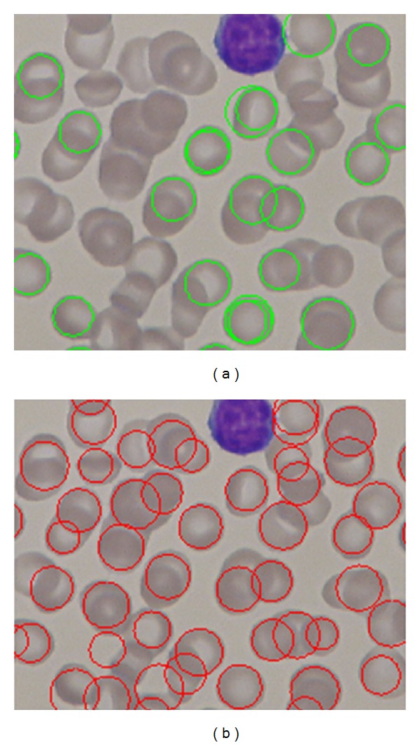 Figure 22