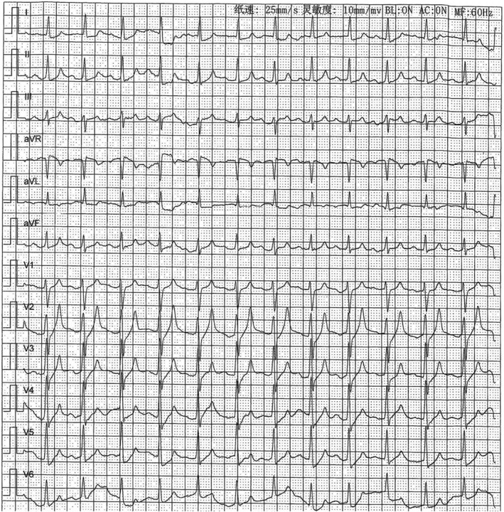 FIGURE 1