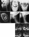 Fig. 2