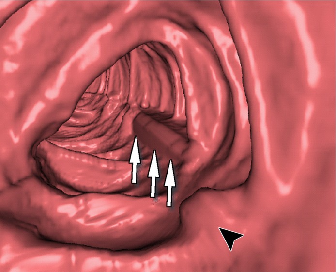 Figure 12e.