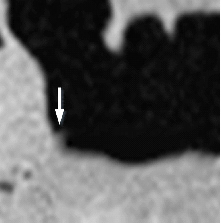 Figure 3c.