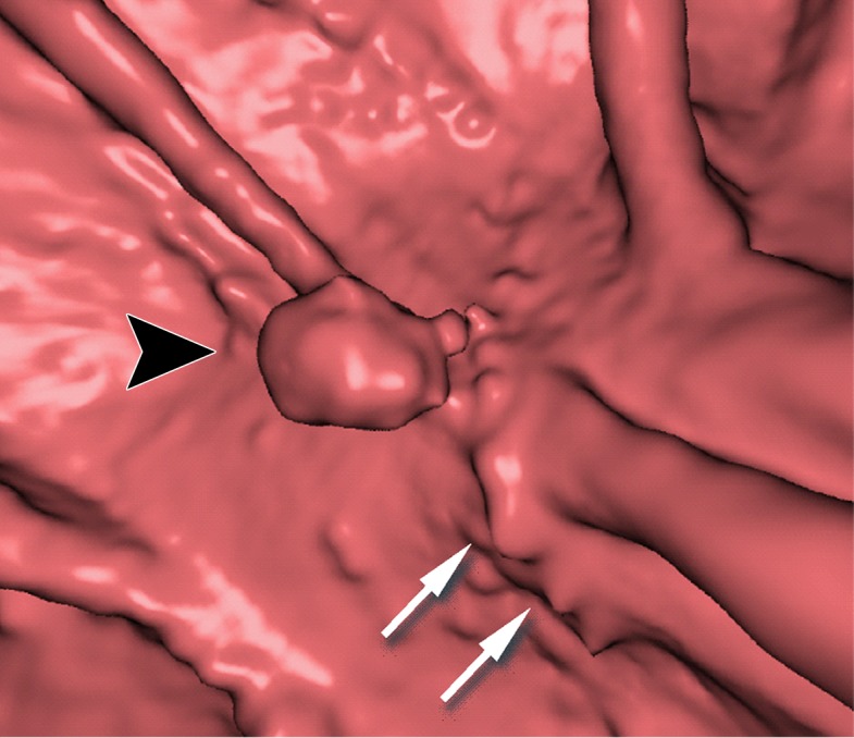 Figure 11f.