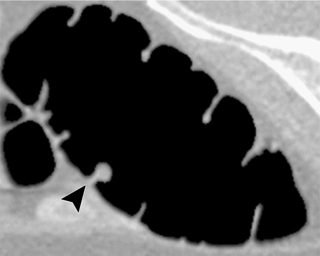 Figure 11g.