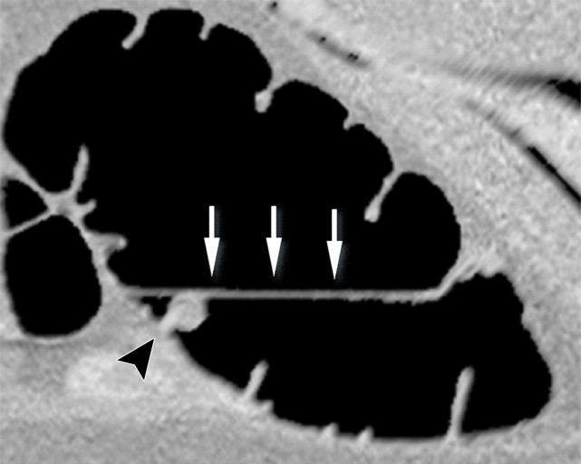 Figure 11c.