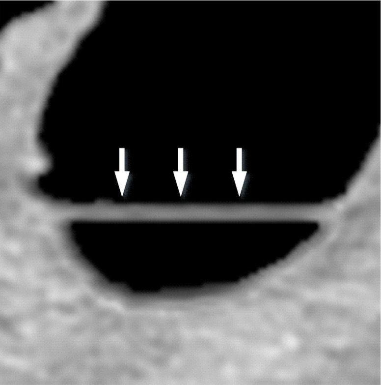 Figure 1c.