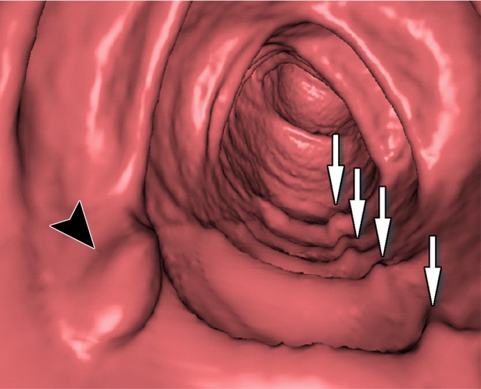 Figure 12f.