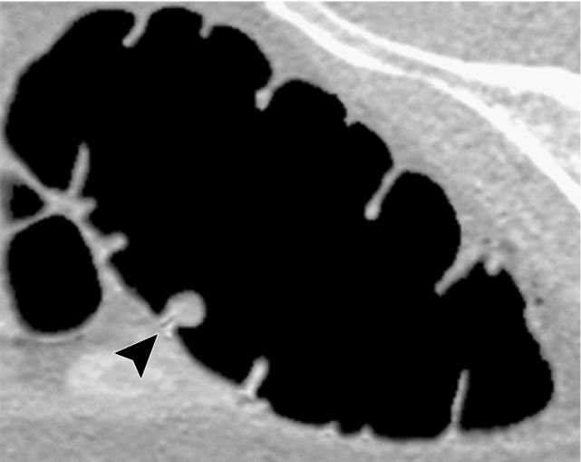 Figure 11e.