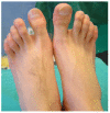 Fig. (1)