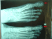 Fig. (2)
