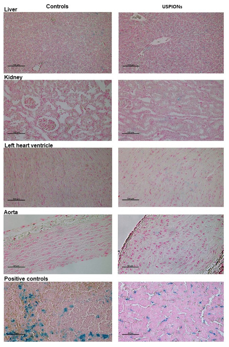 Figure 18