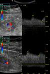 Fig. 2