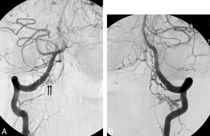 Fig 2.