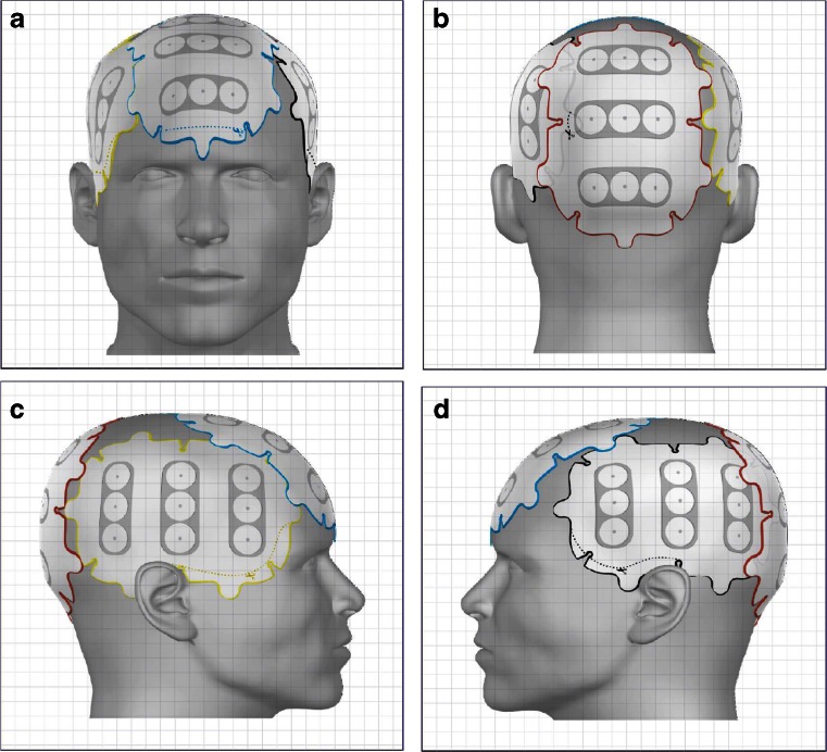 Fig. 2