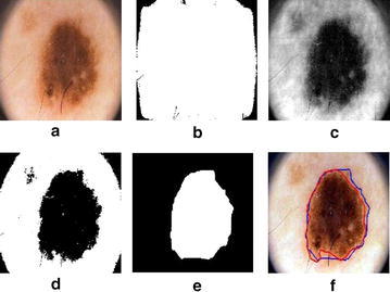 Fig. 11