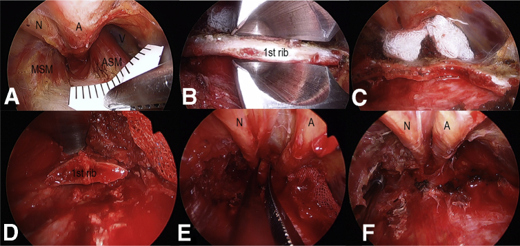 Fig 2