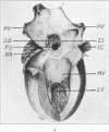 322-3