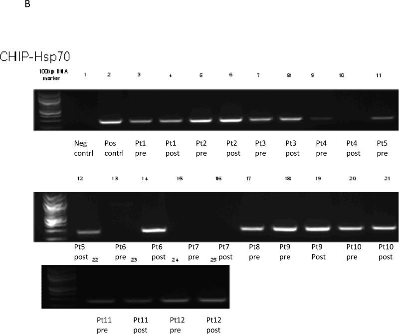 Figure 1B