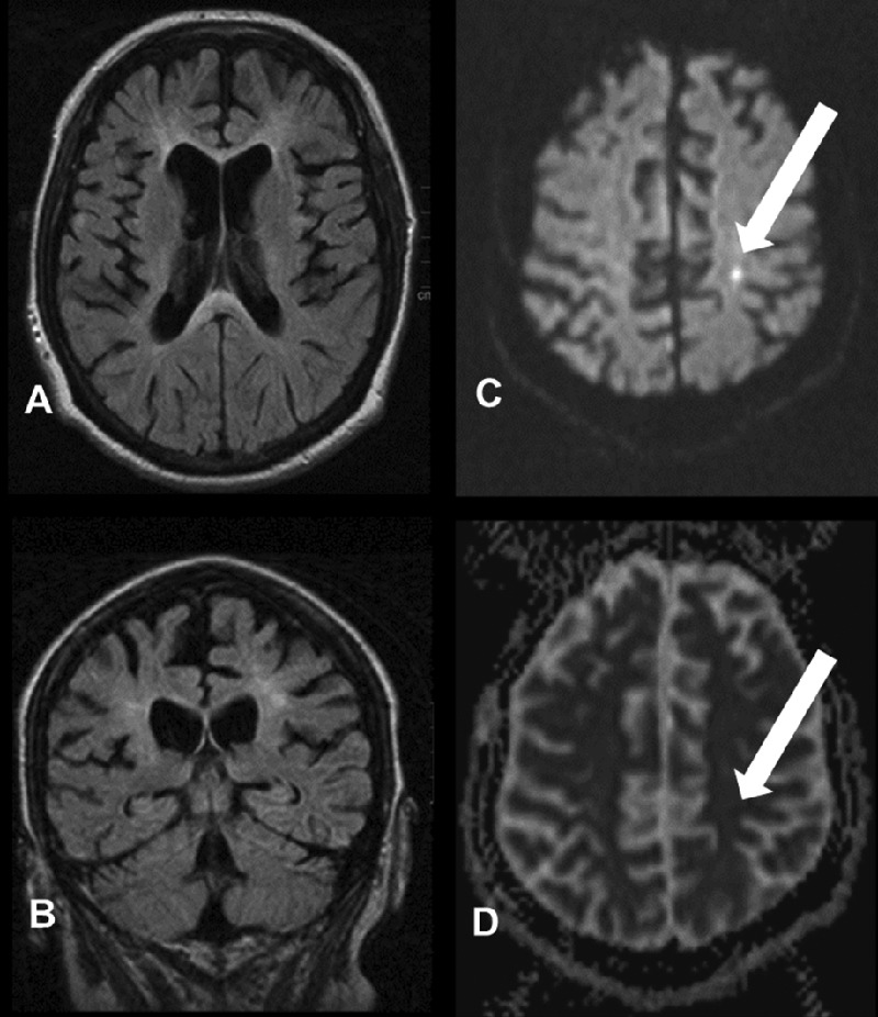 Figure 1