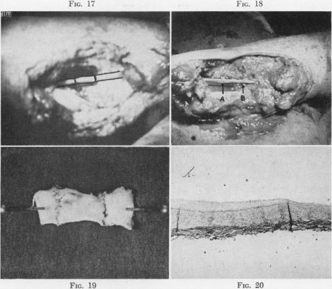 Fig. 17., Fig. 18., Fig. 19., Fig. 20.