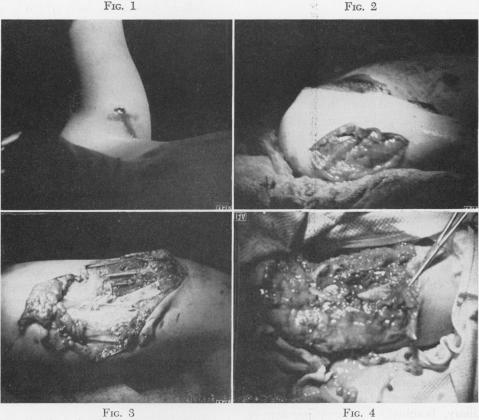 Fig. 1., Fig. 2., Fig. 3., Fig. 4.