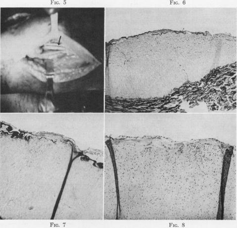 Fig. 5., Fig. 6., Fig. 7., Fig. 8.