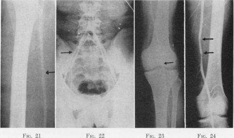 Fig. 21., Fig. 22., Fig. 23., Fig. 24.