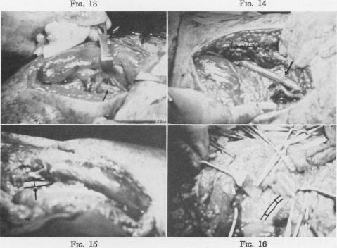 Fig. 13., Fig. 14., Fig. 15., Fig. 16.