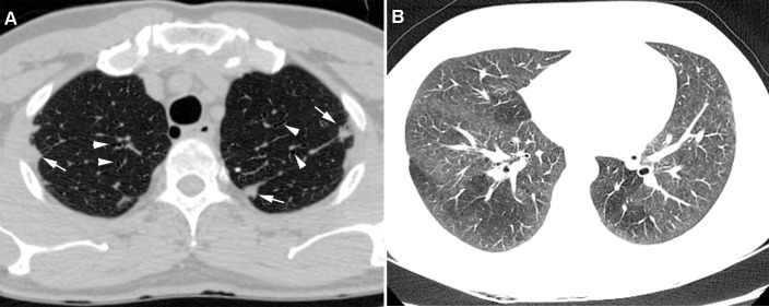 Fig 3