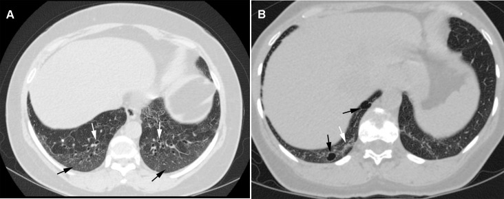 Fig 2