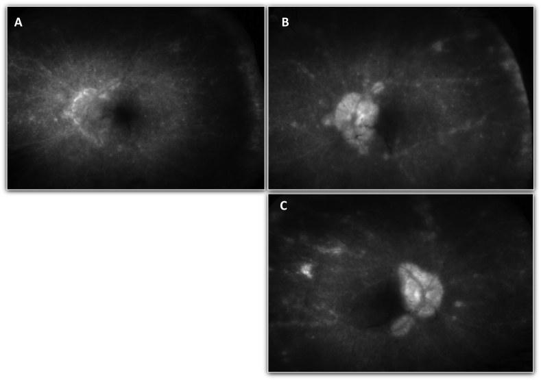 Fig. 1