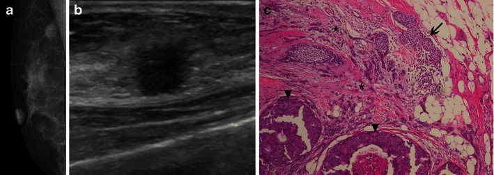 Fig. 14