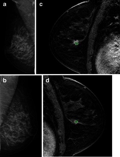 Fig. 11