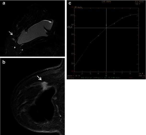 Fig. 9