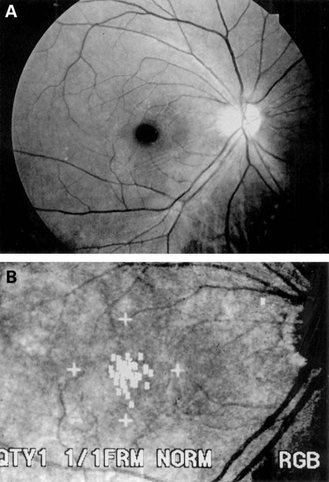 Figure 2  