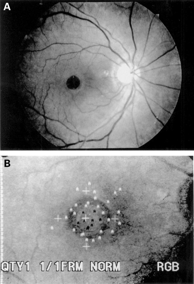 Figure 1  