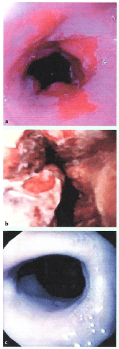 Fig.3