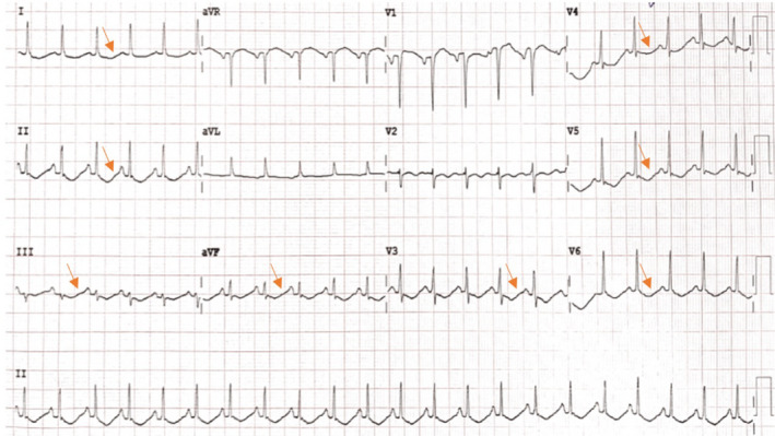 FIGURE 1