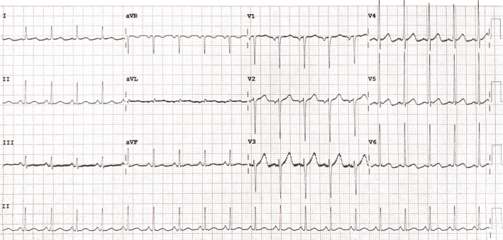 FIGURE 2