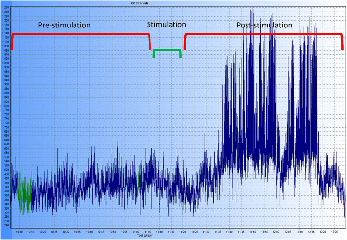 Figure 10