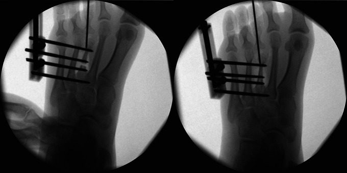 Fig. 10