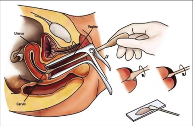 Figure 10: