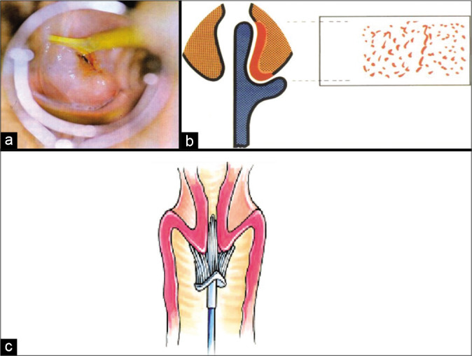 Figure 11: