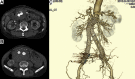 Fig 3