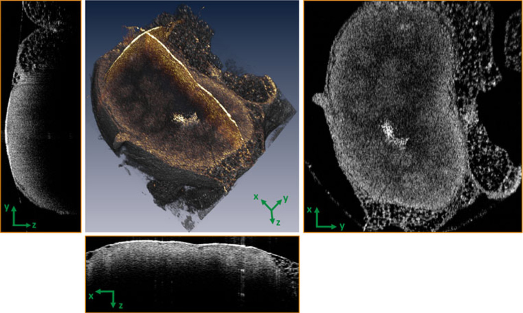 FIG. 1